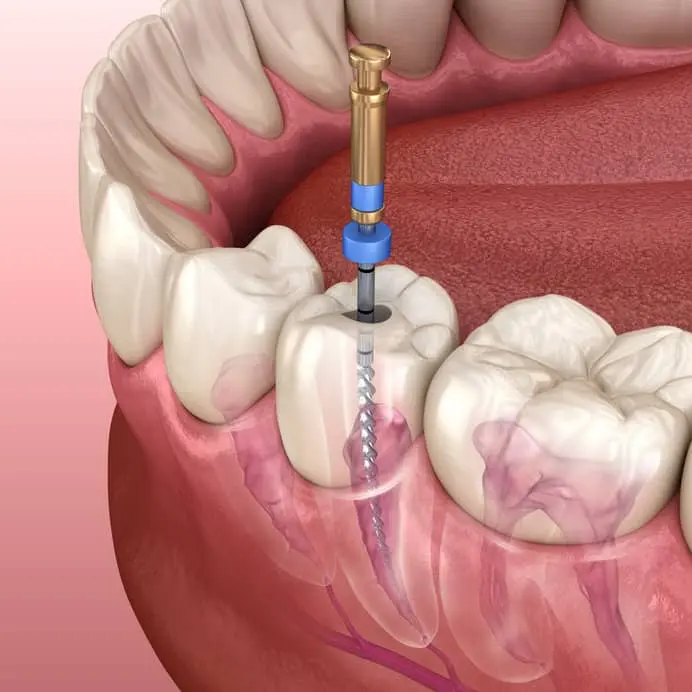 A dentist working on a patient with a treatment light