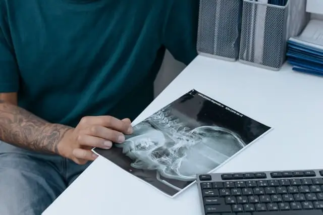 A surgical treatment room laid out for a procedure